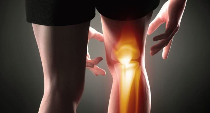 Arthrosis symptoms