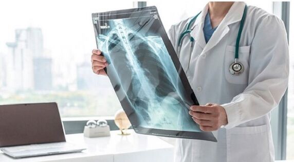 X-ray diagnosis for pain under the left shoulder blade