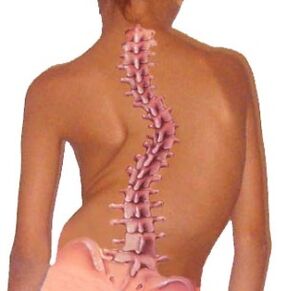 Spine curvature leads to osteochondrosis